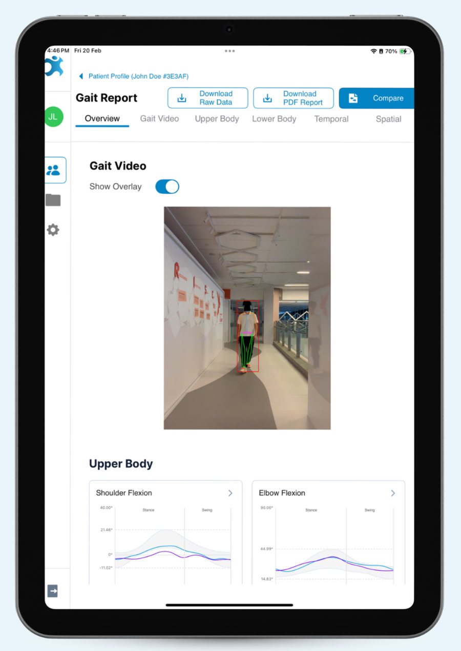A 3DGait gait report on an iPad: the recorded walk and joint-angle charts.